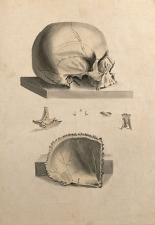Human skull: six figures showing sections and an entire skull, 1830-1835. Creator: Unknown.
