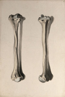 Humerus bone: two figures, 1830-1835. Creator: Unknown.