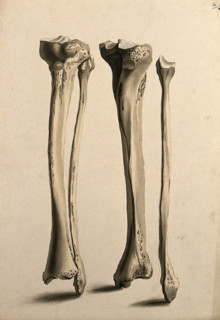 Tibia and fibula bones, 1830-1835. Creator: Unknown.