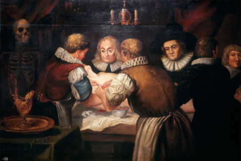 Surgeons performing an operation on a woman's breast in the seventeenth century. Creator: Unknown.