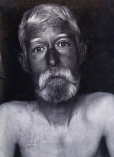 Friern Hospital, London: a patient, facing forwards, 1890/1910. Creator: Unknown.