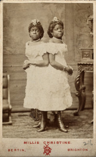 The Millie-Christine sisters, conjoined twins, standing, 1874. Creator: Bertin.