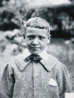 Gloucester smallpox epidemic, 1896: JR Evans, a smallpox patient, after recovery, 1896. Creator: HCF of Gloucester.