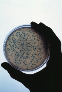 Petri Dish Culture
