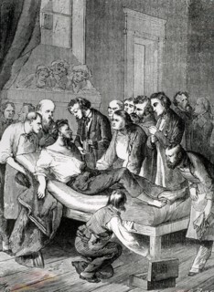 First Anesthesia, by W. T. Morton