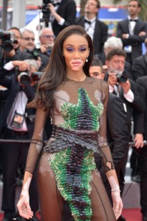 Winnie Harlow