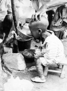 Enfant sous-alimenté au Biafra, 1969