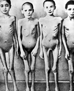 Dans un camp de concentration nazi, des enfants juifs servent de cobayes