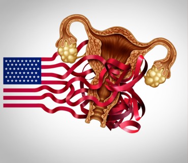 US Abortion law challenges and reproductive rights in the United states as a legal concept for reproduction laws as legislation by government.