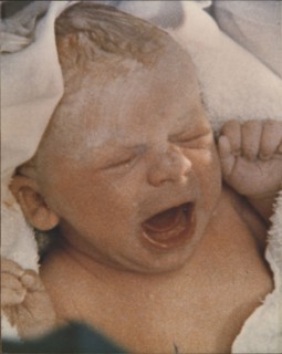 Jan. 1, 1970 - The First Test Tube Baby : Louise Joy Brown just after her birth at the Oldham Hospital on july 25, 1978
