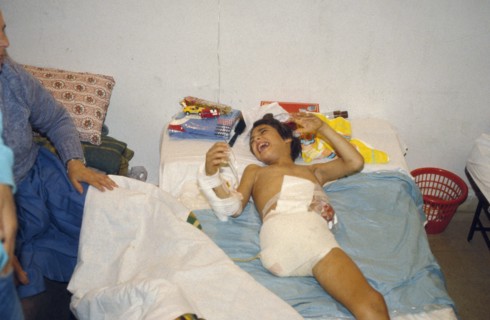 Un enfant victime de la guerre au Liban (1982-83)