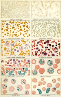 Blood and blood movement, 19th century, blood, blood cell