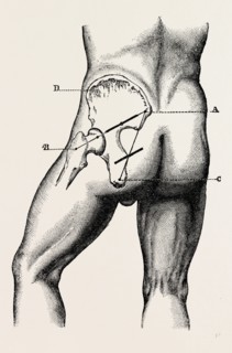 the incisions, medical equipment, surgical instrument, history of medicine