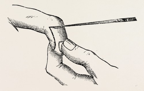 four inches long, a fine key, the mode of holding, medical equipment, surgical instrument, history