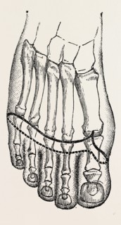 operation, medical equipment, surgical instrument, history of medicine
