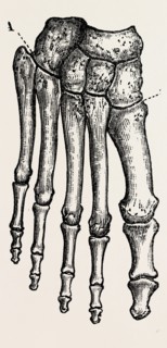 bones, medical equipment, surgical instrument, history of medicine