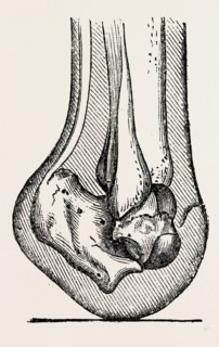 anatomy , medical equipment, surgical instrument, history of medicine
