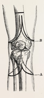 stephen smith's, medical equipment, surgical instrument, history of medicine