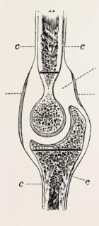 diagrams to illustrate the sub-periosteal method of resection, medical equipment, surgical