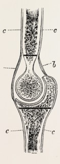 diagrams to illustrate the sub-periosteal method of resection, medical equipment, surgical