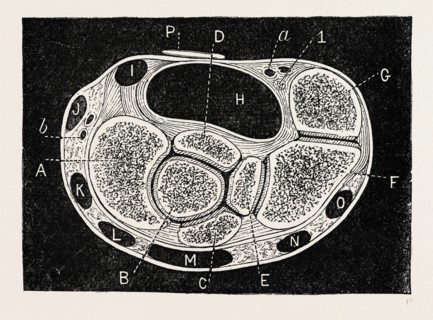 section through, medical equipment, surgical instrument, history of medicine