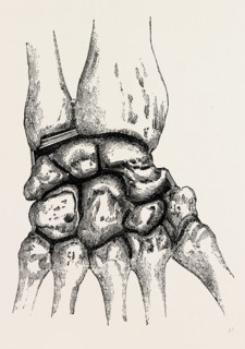 the synovial cavities, medical equipment, surgical instrument, history of medicine