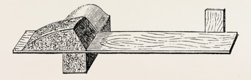 lister' s splint for excision, medical equipment, surgical instrument, history of medicine