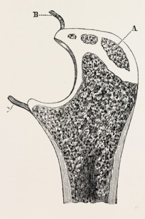 end of the ulna, medical equipment, surgical instrument, history of medicine
