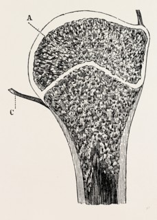 upper end of the humerus, medical equipment, surgical instrument, history of medicine