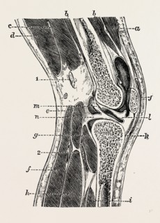 vertical section of knee-joint, medical equipment, surgical instrument, history of medicine