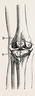 excision of the operation the limb, medical equipment, surgical instrument, history of medicine