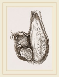 Stomach of Ostrich laid open