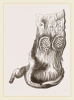Stomach of Adjutant