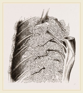 Vascular Apparatus of Whale