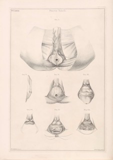 Anatomy of the pelvis, Jacob van der Schley, 1762