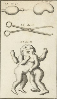 Anatomical image XV, Jan Luyken, Jan Claesz ten Hoorn, 1680 - 1688