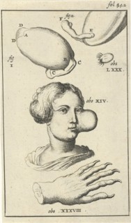 Anatomical image XI, Jan Luyken, Jan Claesz ten Hoorn, 1680 - 1688
