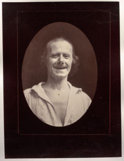 Mécanisme de la physionomie humaine: Figure 32: Rire naturel par la contraction volontaire des deux