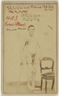 W. D. Gilbert Co, C. 6th Vt. Civil War Victim; American; 1865; Albumen silver print