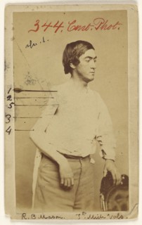 Russell B. Mason Prv. 7th Mich. Inf; Baldwin & Prior, American, 1865 - 1867, about 1865; Albumen silver print