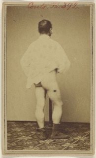 Jno. Hamilton. Civil War victim; Attributed to William H. Bell, American, 1830 - 1910, about 1865; Albumen silver print