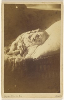 child with head turned to the camera, in bassinet; J. Dupont, Belgian, 1818 - 1901, about 1865; Albumen silver print