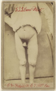 Geo. W. White Pri. Co. E. 7. Ill. Cav. age 25...Civil War victim; Attributed to William H. Bell, American, 1830 - 1910, April