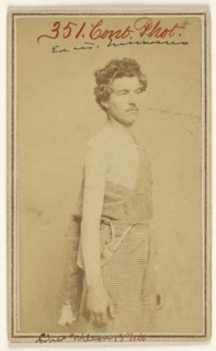 Chas. Wilson Civil War victim; Baldwin & Prior, American, 1865 - 1867, 1865 - 1867; Albumen silver print