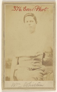 Wm. Whitten Civil War victim; Attributed to William H. Bell, American, 1830 - 1910, 1865 - 1867; Albumen silver print