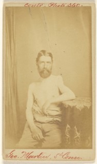 Geo. Martin, 5th Conn. Civil War victim; S. Friedlaender, American, active 1860s, 1864 - 1866; Albumen silver print