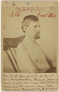 Priv. W.A. Henderson, Civil War vicitim; W. Thompson, American, active 1860s, May 1864; Albumen silver print