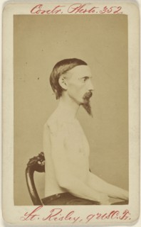 Lt. D.G. Risley q USC. Tr. Civil War victim; American; 1862 - 1864; Albumen silver print