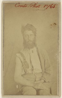 Civil War victim, seated; American; 1865 - 1870; Albumen silver print