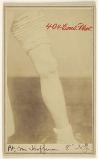 Pt. M. Hoffman, 8' N.J. Civil War victim; Dr. R.B. Brown, American, active Washington, D.C. 1860s, 1862 - 1864; Albumen silver